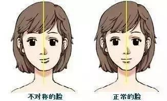 你的脸为什么会一边大一边小,新生儿的脸一边大一边小如何矫正