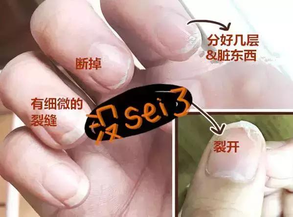 为什么剪指甲指甲会乱飞,剪指甲的时候指甲飞到鼻孔里