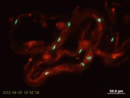 直男癌还有救吗,直男癌有哪些