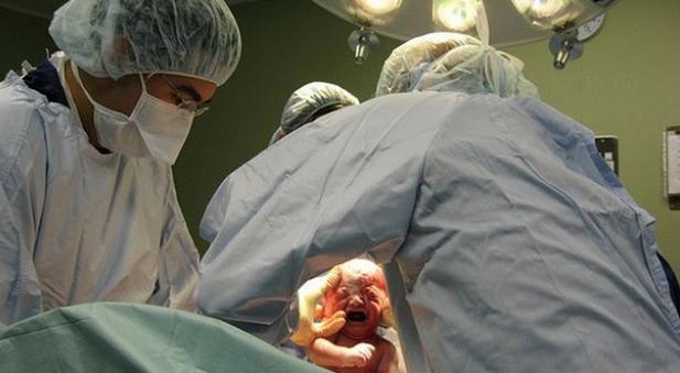 实拍胎儿剖腹产过程，“捧在手里怕摔了，含在嘴里怕化了”！