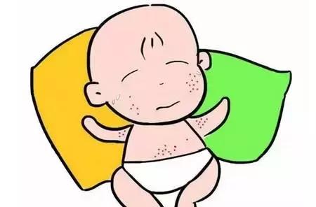 如何区分痱子和湿疹婴儿,湿疹和痱子怎么判断