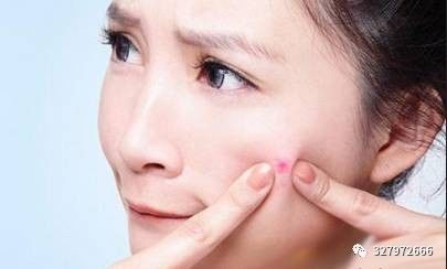 用朵嘉浓反反复复长痘,朵嘉浓治疗激素脸的例子