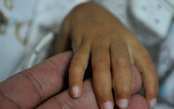 8岁女孩反复高烧第四天,8岁女童半夜发高烧