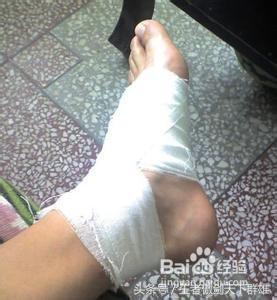 脚崴到了肿了应该怎么办,脚崴到了肿了怎么办多久可以好