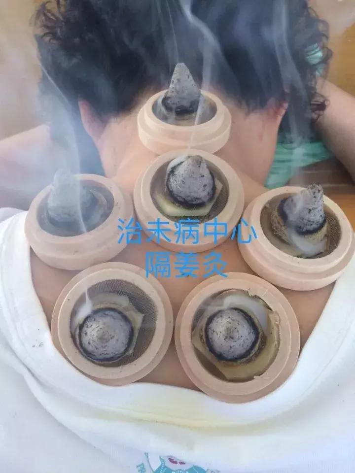 驻马店市中医院微创技术,治未病科中医特色门诊