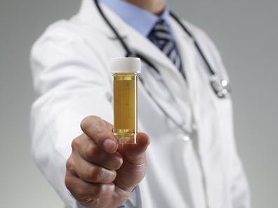 为什么很多人有尿蛋白,如何简单判断是否有尿蛋白