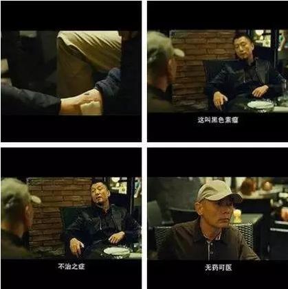 丢失孩子出生时脖子后面有胎记,婴儿出生胎记用不用去除