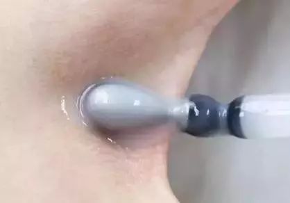 熬夜太多了皮肤变得有多差,一直熬夜皮肤很差怎么改善