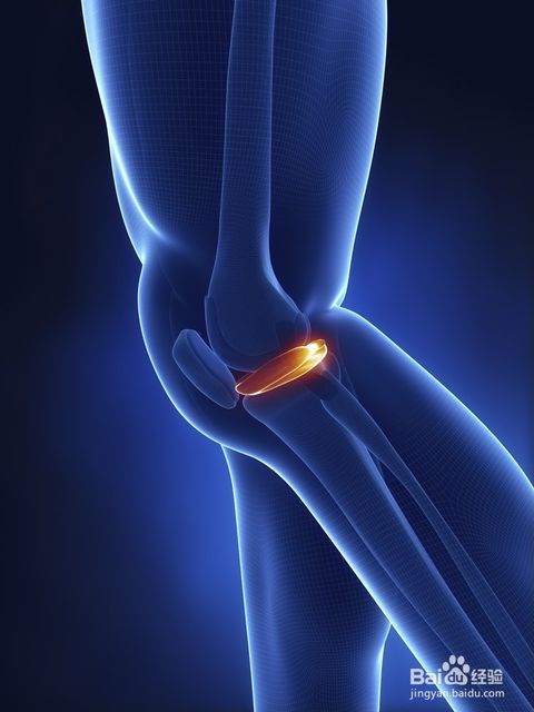 骨折后的骨质疏松可怕吗,骨质疏松厉害是不是骨折不容易好