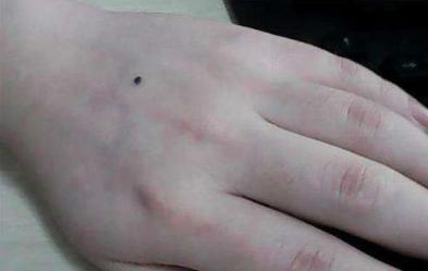 手背长痣的女人有什么特征,手背有痣的女人右手