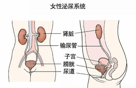 就医搜｜尿路感染偏爱女性女性患病率是男性8-10倍