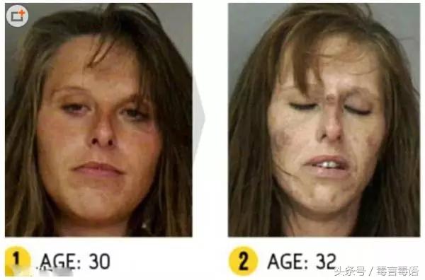 吸毒前后的变化对比,吸毒真的会毁容吗