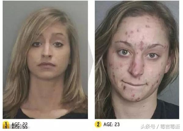 触目惊心吸毒前后真实的变化,吸毒的危害到底有多严重图片