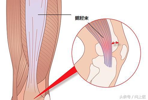高中生膝盖疼痛的原因和解决方法,膝盖内侧靠下位置疼痛是什么原因