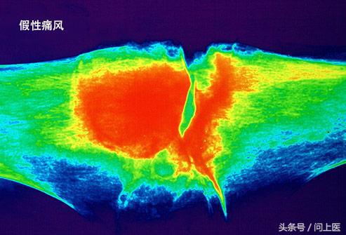 老年人膝盖疼痛的原因和解决方法,上楼梯膝盖疼痛的原因和解决方法