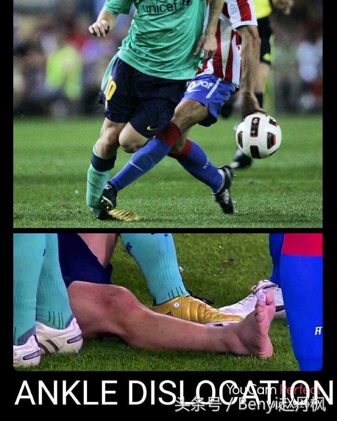 脚踝受伤半年后如何康复训练,脚踝伤病的六个问题