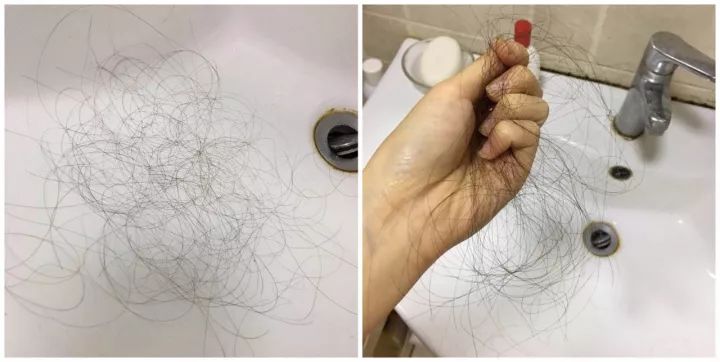 90后的叔叔阿姨，你的头发掉了