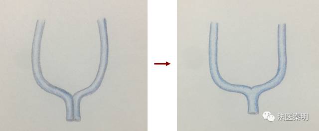 三胞胎的子宫变化,他们是三胞胎姐妹