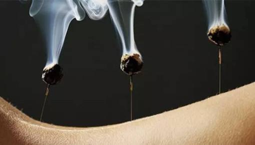 艾灸前艾灸后要注意事项,艾灸新手必学的几种艾灸技法