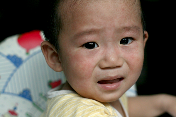 幼儿急疹全攻略,幼儿急疹的100个常识