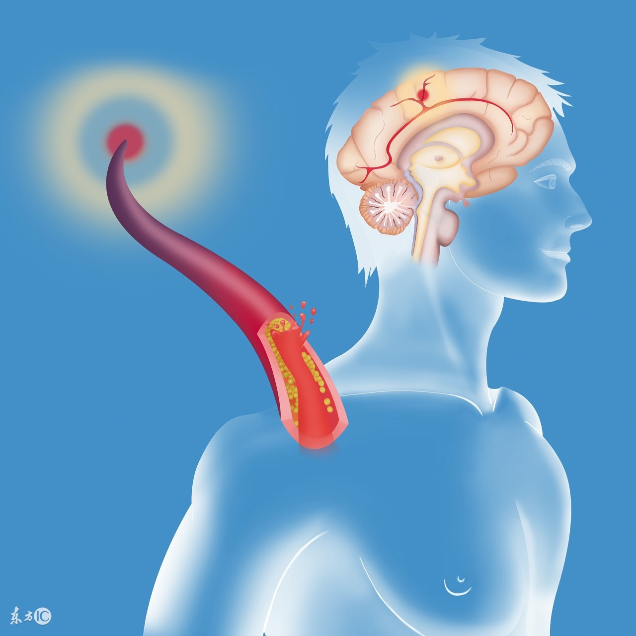 糖尿病危害大还是高血压危害大,高血压可怕还是糖尿病可怕