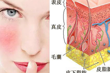 修复角质层薄红血丝敏感肌护肤品,皮肤角质层薄脸发红用什么药修复