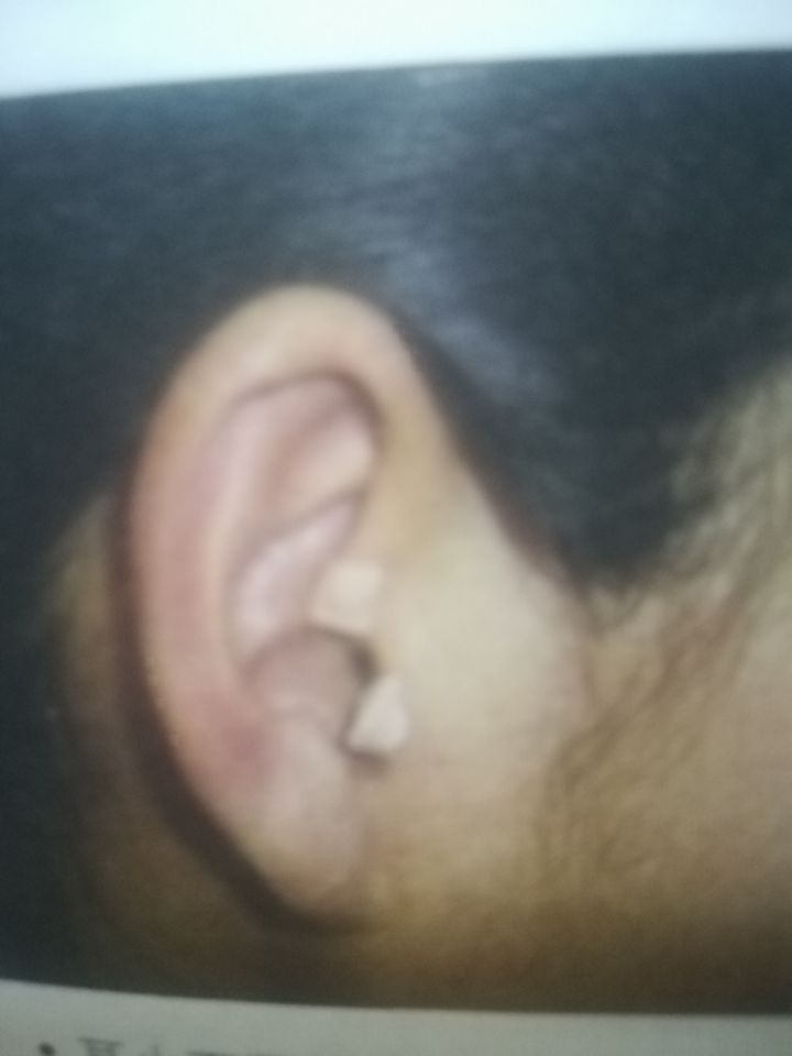 一学就会的观耳辨病法,观耳识病