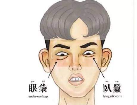 色素型黑眼圈加眼袋怎么解决,戳到眼睛眼白一块血块怎么办