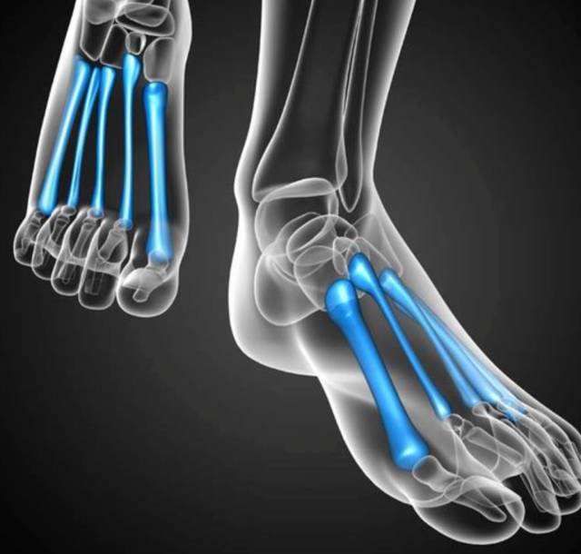 「Phatkix专栏」鞋舒不舒服？脚说了算|NikeFree专栏·下篇