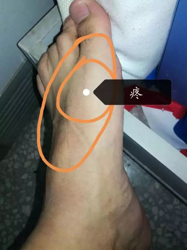 答疑（72）：站着跑，蹲着接