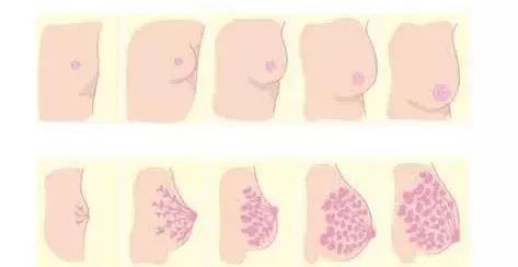 怀孕了乳房胀痛怎么办,怀孕多久出现乳房胀痛