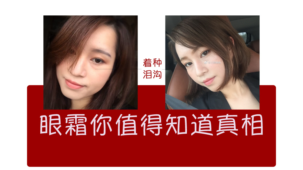 女大学生泪沟黑眼圈用什么眼霜,眼霜能去脂肪粒吗