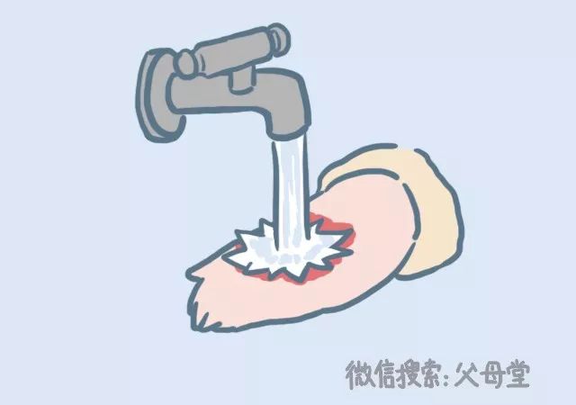 宝宝怎么防冻伤,宝宝烫伤天气热怎么护理