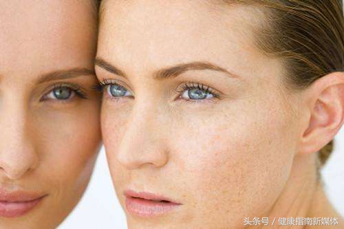 怎样内调才能去掉脸上的斑,怎么才能把脸上的斑纹去掉