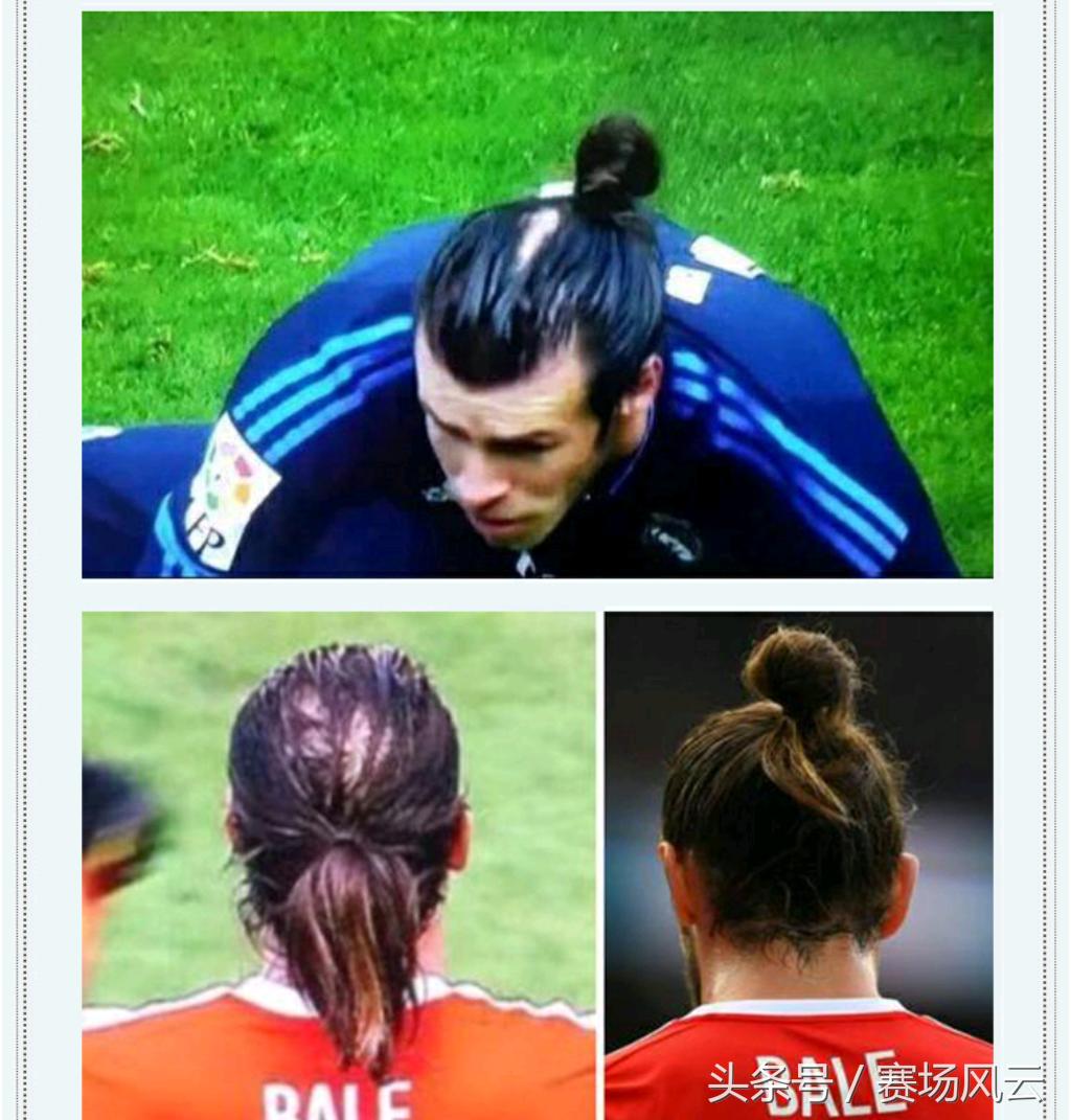 足坛那些剃光头的球员,足坛秃头最强十一人