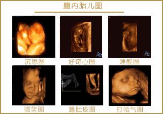 怀孕一般要做几次B超？最重要的是哪次？各种超声检查有何区别？