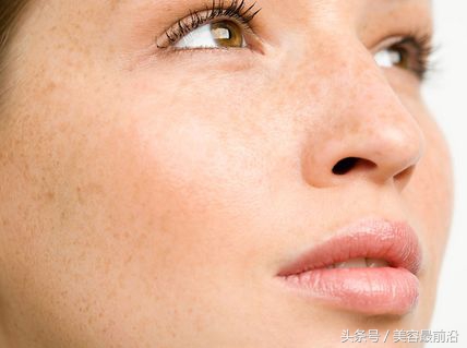 如何去掉脸上烦人的雀斑,怎么去除脸上的雀斑最快