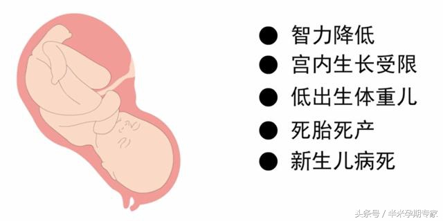 孕期甲减tsh偏低,孕期甲减没吃优甲乐