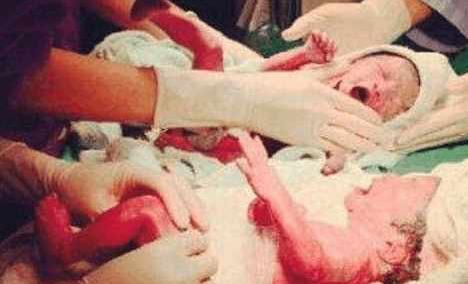 剖腹产一周后产妇伤口崩开,剖腹产刀口崩裂怎么处理