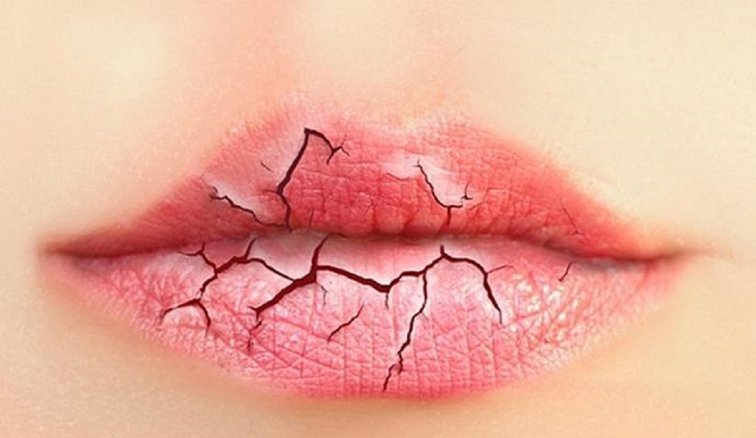 「美肤颜习会」冬天嘴角干裂不要舔，两个小绝招让你安然过冬！