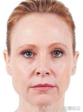 如何用软件消除法令纹,消除法令纹一般多少钱