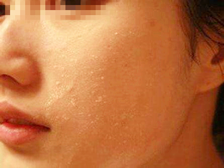 6个月婴儿手上长倒刺涂什么,宝宝手上起倒刺手指头起皮