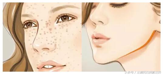 祛斑成功堪比整容,激光祛斑显老