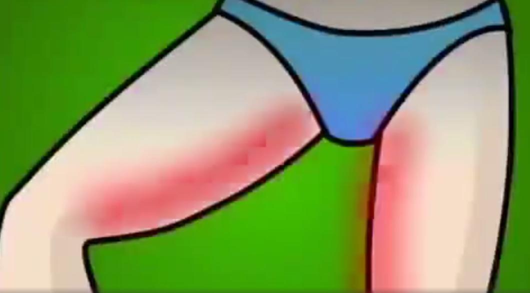 腿粗根本原因就是两腿之间赘肉太多，下半身臃肿，身高明显低一截