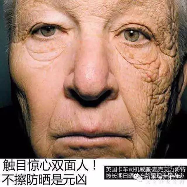 欧美阿姨PK日本大妈——差了10斤胶原蛋白！