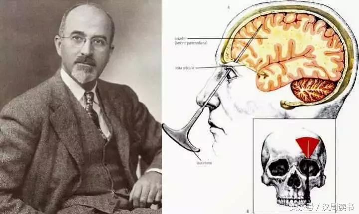 他用一根长钉从眼眶锤入那个人的头颅竟只为了治精神病