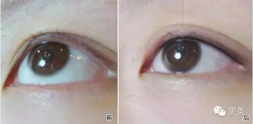 韩式半永久,韩式半永久都有什么