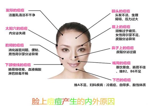 关于痘痘的解答,一篇文章终结你关于痘痘的疑问