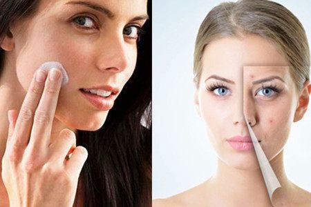 红霉素祛痘印效果好吗,红霉素祛痘印的正确方法