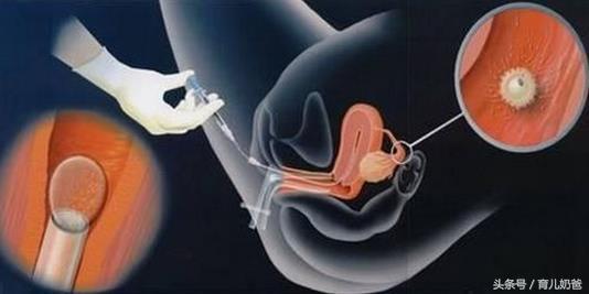 试管婴儿怎么回事,试管婴儿到底怎么回事